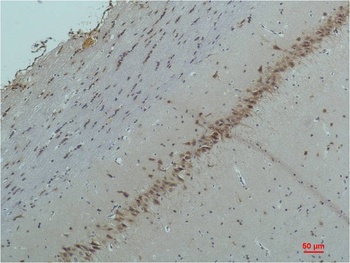 CaVα2δ2 Rabbit pAb Antibody
