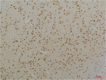 Cav1.2 antibody