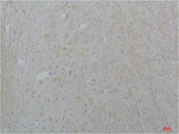 Cav2.2 Rabbit pAb Antibody