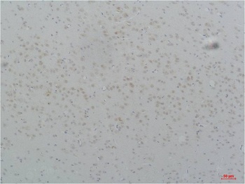 Cav3.2 Rabbit pAb Antibody