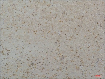 Cav3.2 Rabbit pAb Antibody