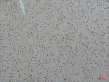 Cav pan alpha1 antibody