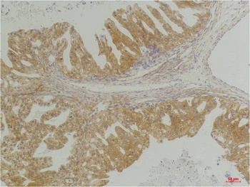 CXCR4 Rabbit pAb