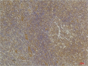 CXCR4 Rabbit pAb