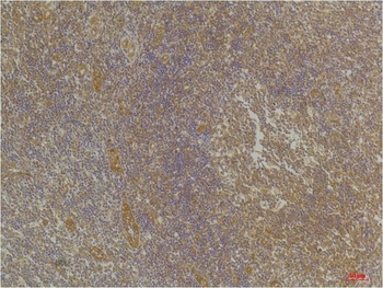 CXCR4 antibody