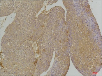 EphA1 antibody