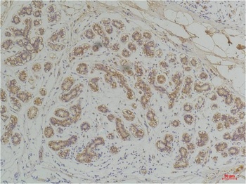 EphA1 antibody