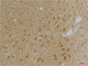 GABA A Receptor α3 Rabbit pAb