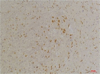 GABA A Receptor α4 Rabbit pAb