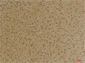 GABA A Receptor γ2 Rabbit pAb Antibody