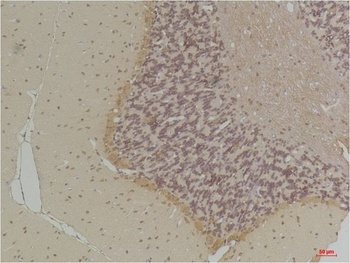 GABA Transporter 1 antibody