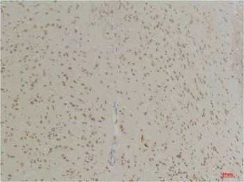 GABA Transporter 1 Rabbit pAb