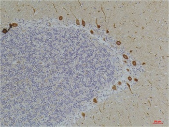 Ghrelin Receptor antibody