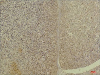 GLP-1 antibody