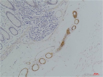 GRIK2(GluR6) Rabbit pAb