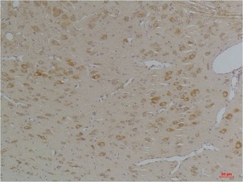 KChIP3 Rabbit pAb Antibody