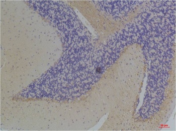 KChIP3 antibody