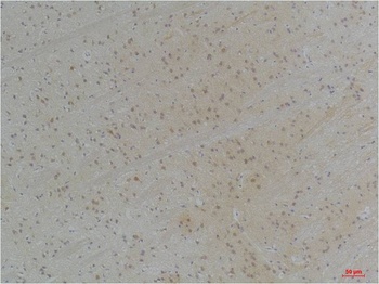 KVβ1 Rabbit pAb
