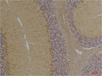 Kv1.8 antibody