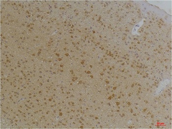 Kv1.8 antibody