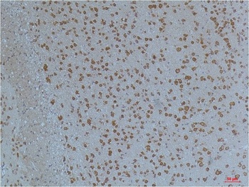 Kv11.1 Rabbit pAb