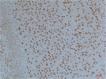 Kv11.1 antibody