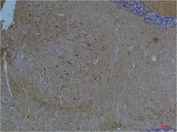 Kv11.3 antibody