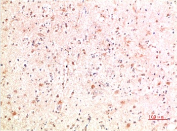 PI3 Kinase P85 Rabbit pAb Antibody