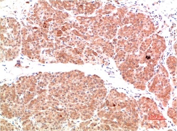 PI3 Kinase P85 Rabbit pAb Antibody