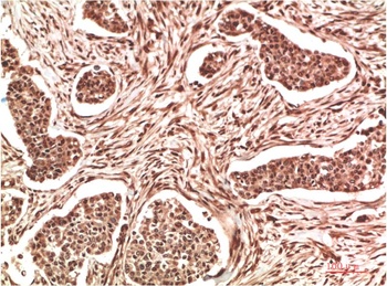 NM23A antibody