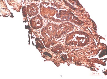 ATM antibody