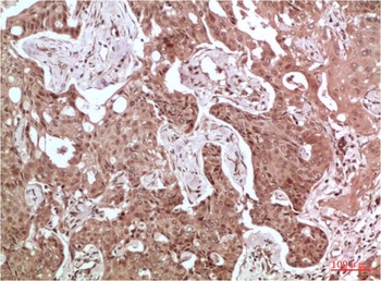Acetyl-CoA Carboxylase Rabbit pAb