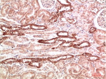 AMPK γ1 Rabbit pAb