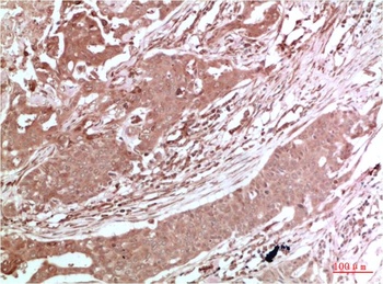 AMPK α2 Rabbit pAb