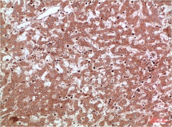 AMPK α2 Rabbit pAb