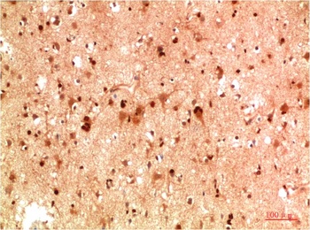 HSP40 Rabbit pAb