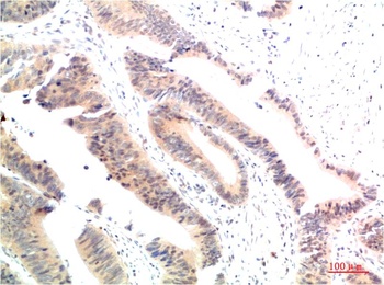 HSP90α Rabbit pAb Antibody