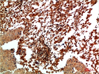 JNK2 Rabbit pAb Antibody