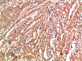 JNK2 Rabbit pAb Antibody