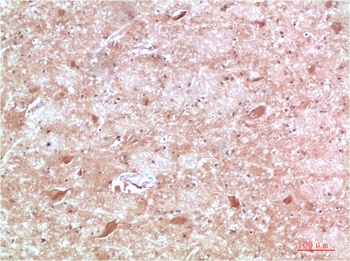 ATG13 Rabbit pAb