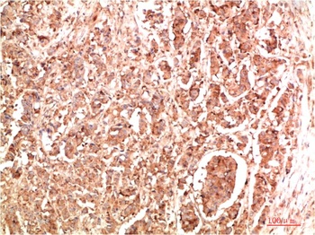 NBR1 antibody