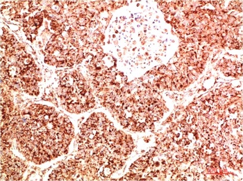FAK Rabbit pAb Antibody