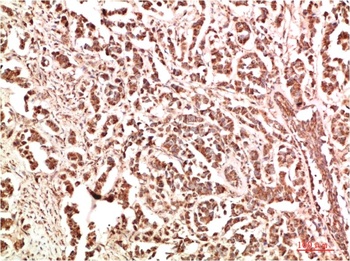FAK Rabbit pAb Antibody
