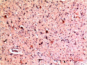 PI3 Kinase P85 Rabbit pAb Antibody