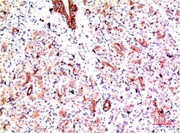 PI3 Kinase P85 Rabbit pAb Antibody