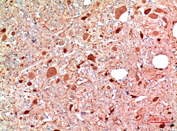 PGP9.5 (UCHL-1)Rabbit pAb