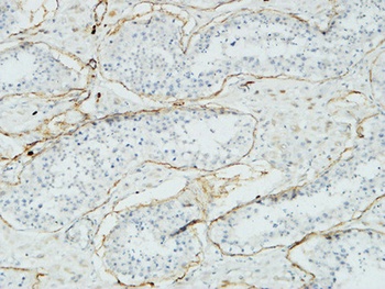 Acrosin antibody