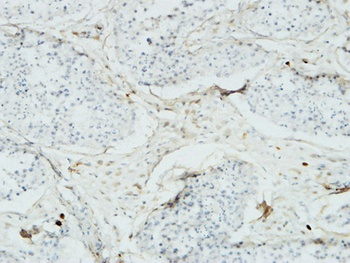 Acrosin antibody