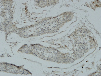 Acrosin antibody