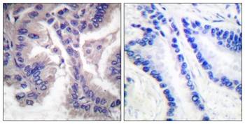 Cleaved-Caspase-6 p18 (D162) rabbit pAb